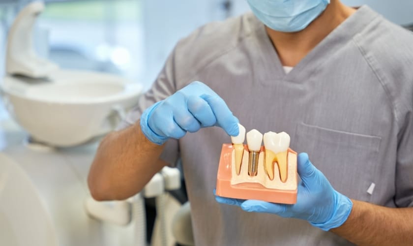 What To Expect When Getting Dental Implants: A Comprehensive Guide